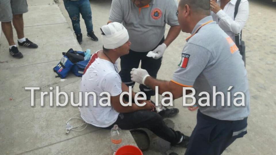 27537483_10215750855548696_10127803_o Agreden a joven para robar una motocicleta