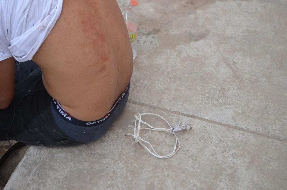 30y31Sucesos (9) Salvaje golpiza para robarlo