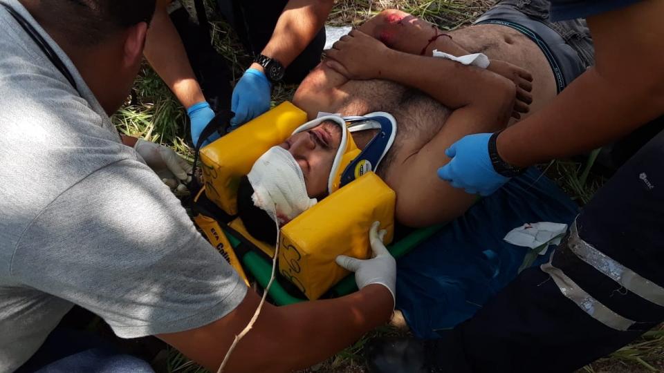 30y31Sucesos (8) Motociclista herido sobre la 544