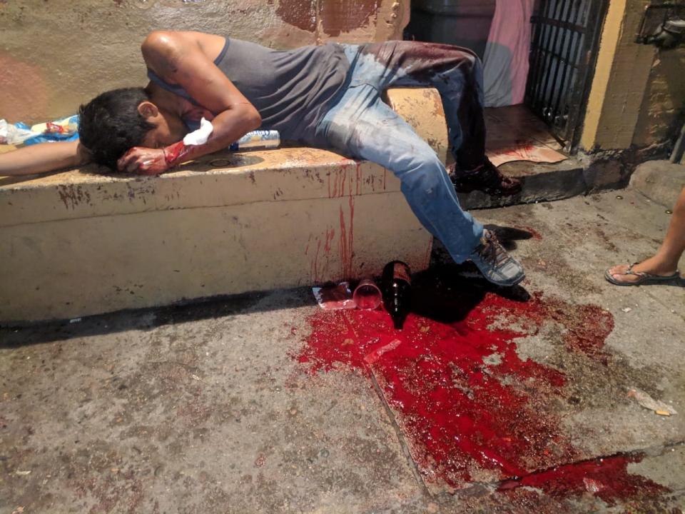 30y31sucesos (12) Apuñalado por su “amigo”