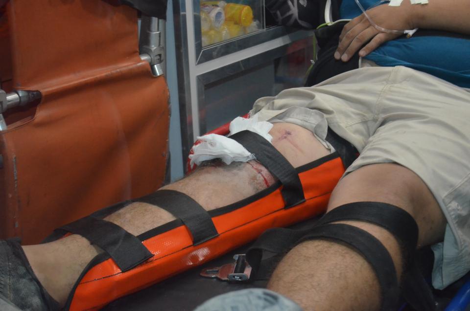 30y31Sucesos (6) Atropellan a menor en motocicleta