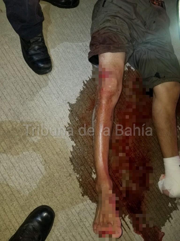 BlurImage_10-8-2019-8-54-57_wm Mordido por cocodrilo al invadir su habitat
