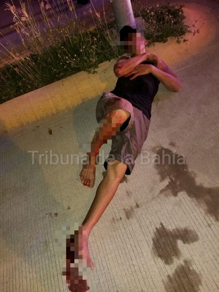 Mordido cocodrilo Tras invadir su hábitat, cocodrilo lo mordió