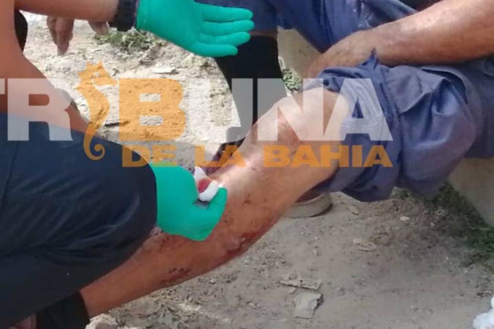 New Project - 2019-12-19T120849.350 Perro le desgarra la pierna a un hombre en colonia Loma Bonita
